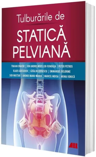 Tulburările de statică pelviană