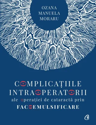 Complicațiile intraoperatorii ale operatiei de cataractă prin facoemulsificare